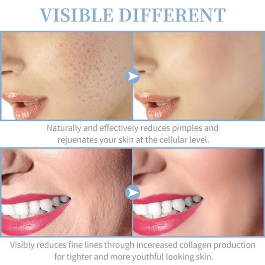 4 in 1 Electrode Glass Tube Machine High Frequency Skin Spot Acne Wand